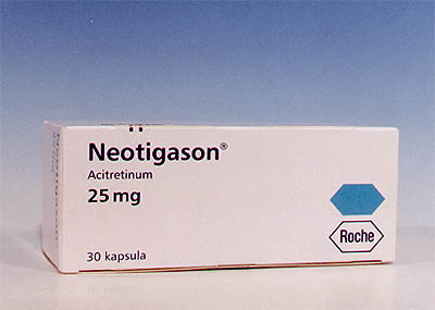 NEOTIGASON para la psoriasis